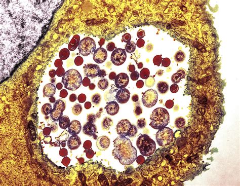chlamydia microscopy.